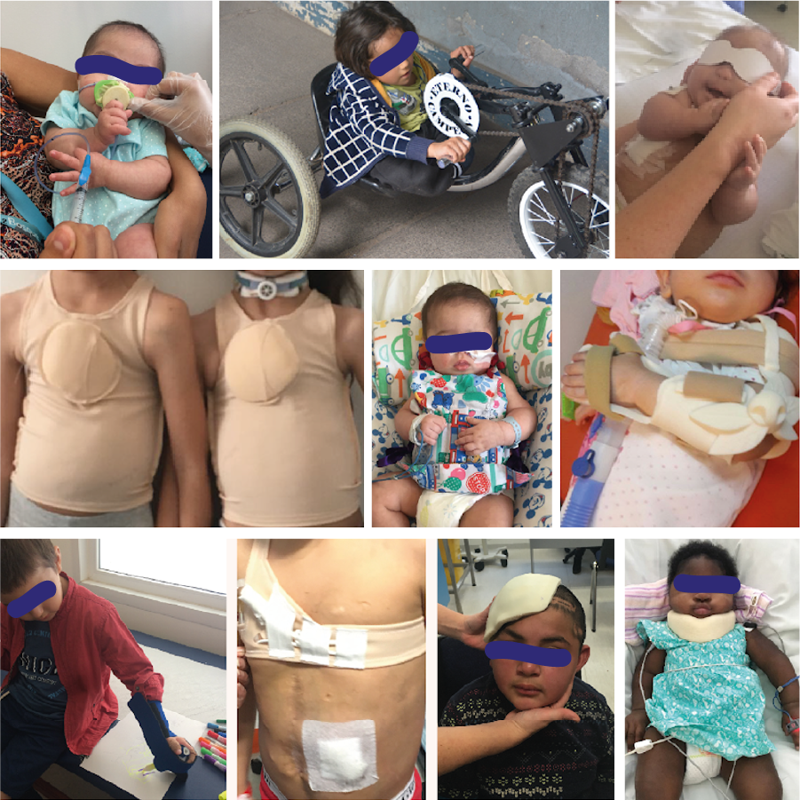 Entrega de tecnologías de apoyo para niños en situación de discapacidad.